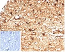 Aldehyde Dehydrogenase 1-A1/ALDH1A1 Rabbit anti-Human, Clone: ALDH1A1/7011R,